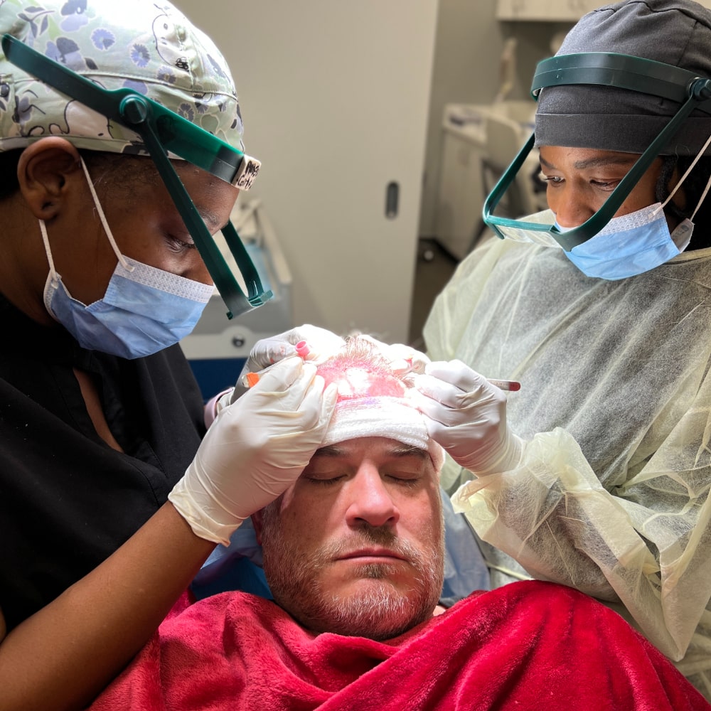 Jason Johnson undergoes hair transplant surgery in Atlanta
