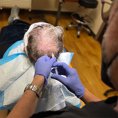 14 Tim Welbaum's hair transplant journey at Atlanta Center for Hair in Atlanta