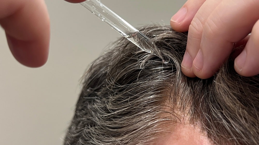 For hair loss basics and hair transplant info turn to Anderson Center for Hair in Atlanta