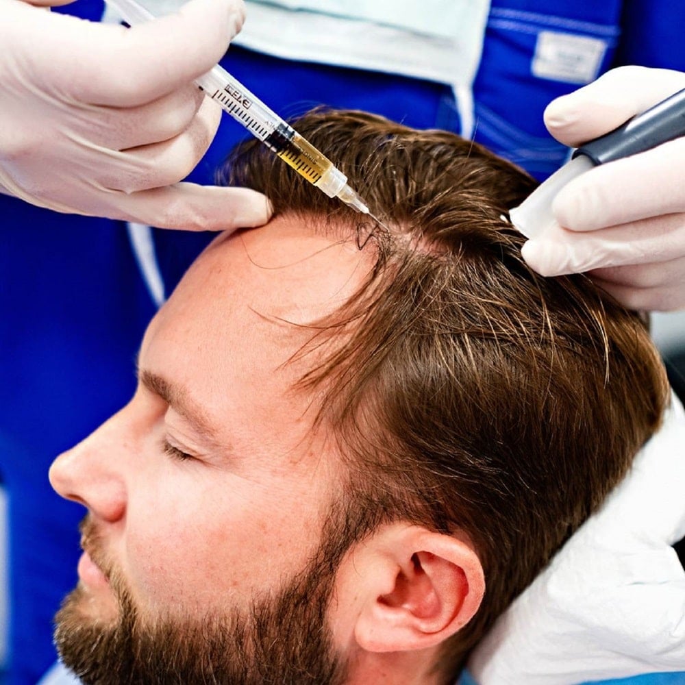 For hair transplant information and hair loss basics turn to Anderson Center for Hair in Atlanta