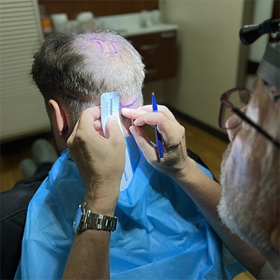 8 Tim Welbaum's hair transplant journey at Atlanta Center for Hair in Atlanta