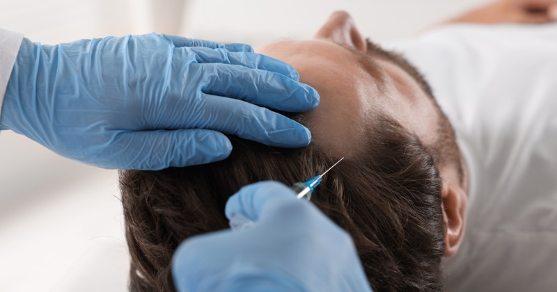 Beyond Surgery: Non-Invasive Solutions for Hair Loss You Need to Know About